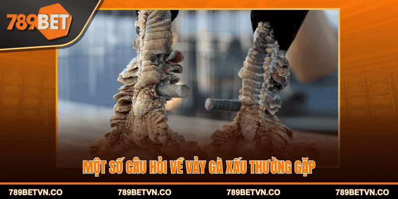 Một số câu hỏi về vảy gà xấu thường gặp